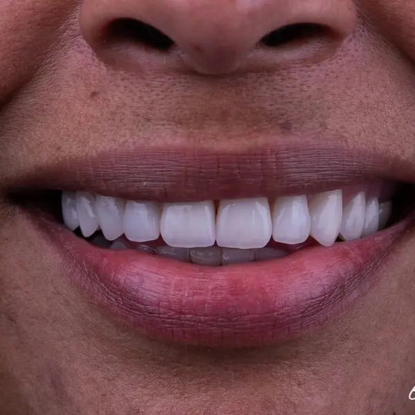 Final result - smile analysis