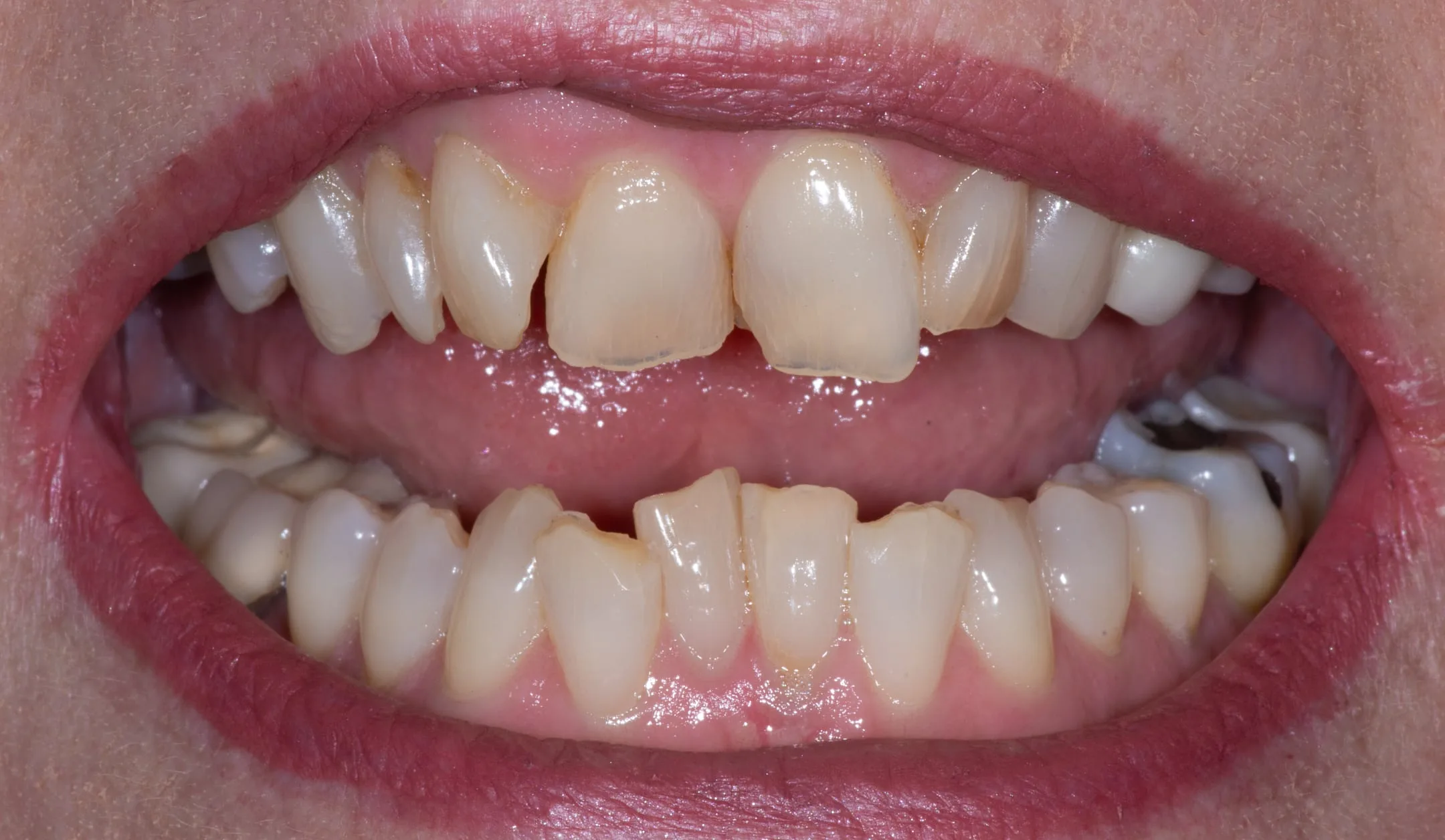 Case 16: Comprehensive Treatment
